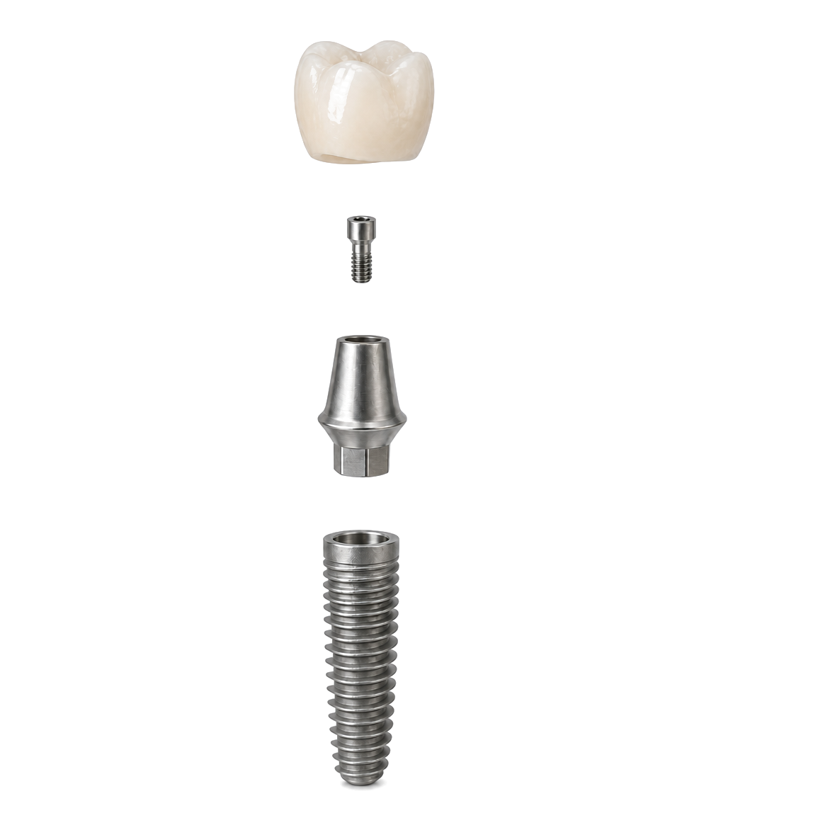 Kaplama, bağlantı vidası, dayanak ve implant gövdesi